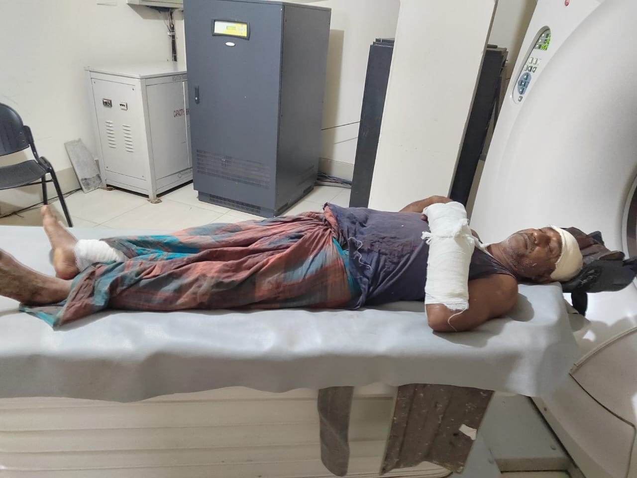 চৌদ্দগ্রামে পূর্ব বিরোধে হামলা-লুটপাট, নারী সহ আহত ৫