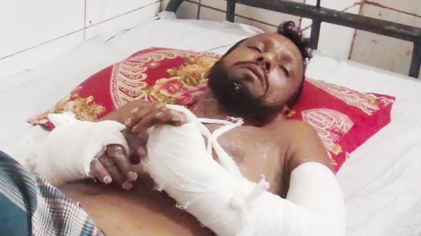 কুমিল্লায় চাঁ দা বাজির জেরে মৎস্য ব্যবসায়ীর উপর নৃশংস হামলা