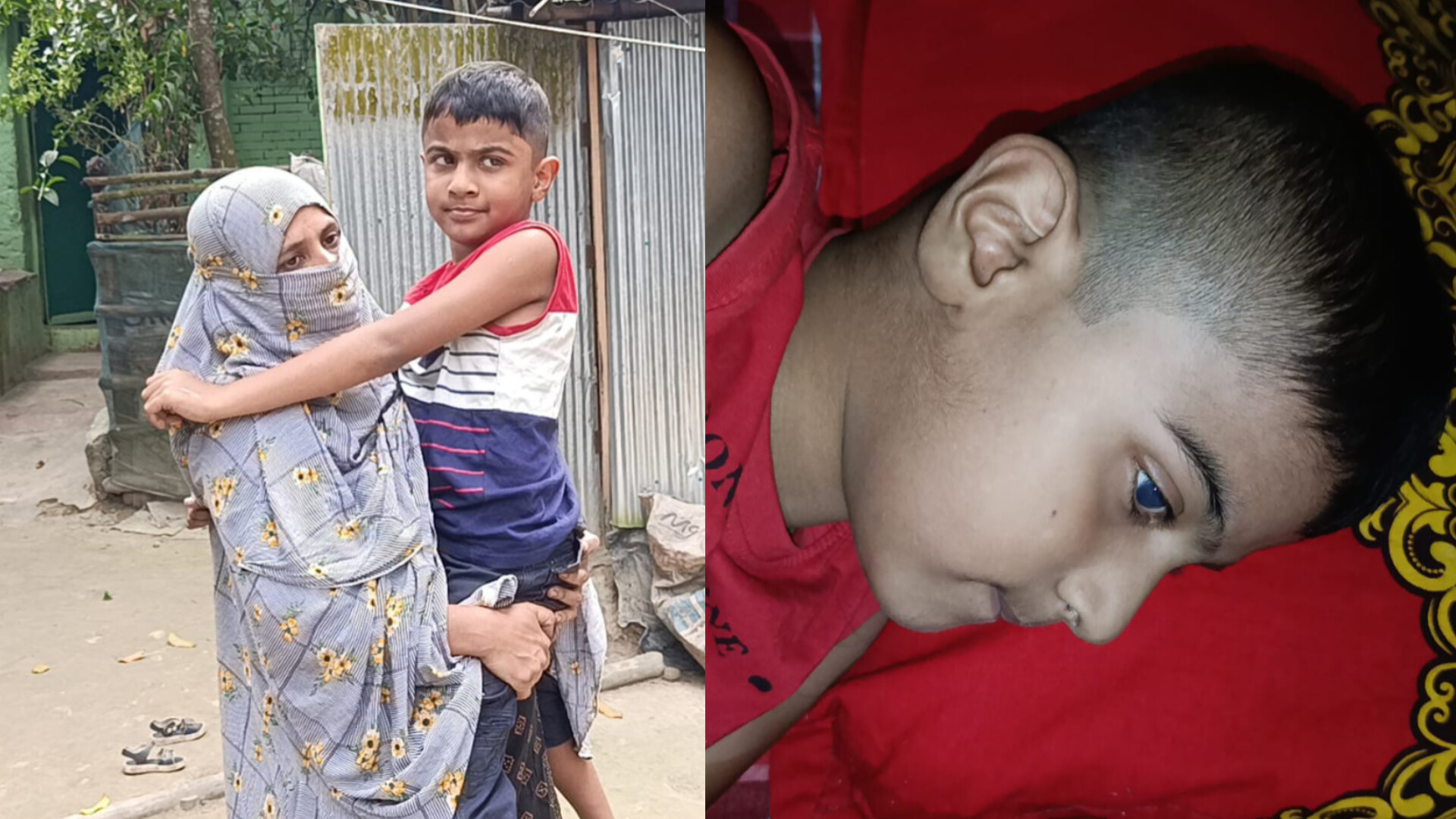 সুচিকিৎসার অভাবে মৃ-ত্যু-ঝুঁকিতে DMD আক্রান্ত চৌদ্দগ্রামের শিশু জিহাদী