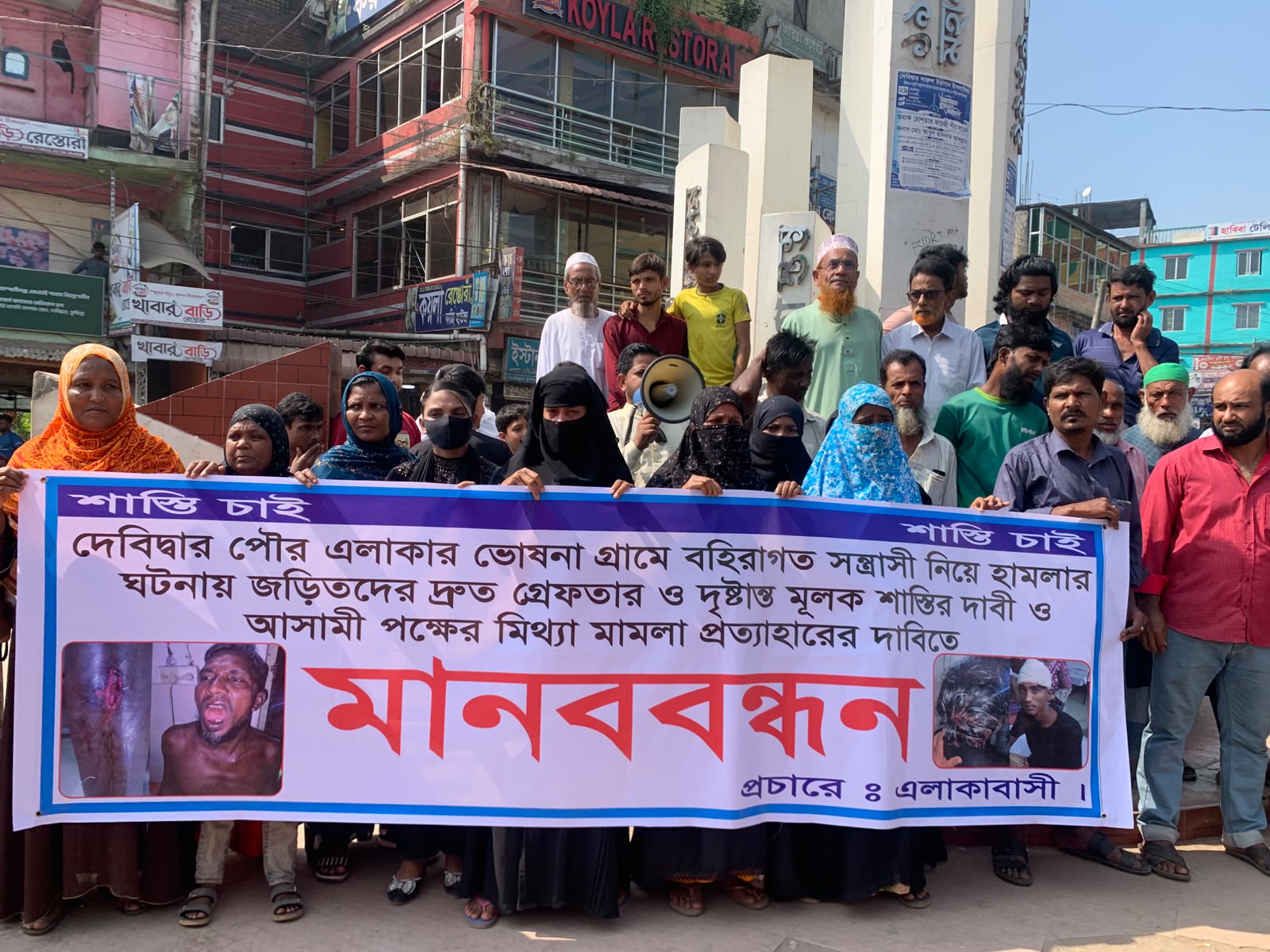 দেবীদ্বারে ন্যায় বিচারের দাবীতে মানববন্ধন; এসআই অজয়ের বিরুদ্ধে নিরপেক্ষ তদন্তের দাবি